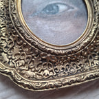Eye